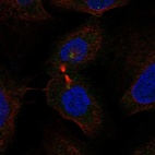 Anti-WDR62 Antibody