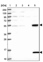 Lane 1: Marker [kDa] 250, 130, 95, 72, 55, 36, 28, 17, 10_br/_Lane 2: Human cell line RT-4_br/_Lane 3: Human cell line U-251MG sp_br/_Lane 4: Human plasma (IgG/HSA depleted)_br/_Lane 5: Human liver tissue