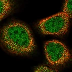 Immunofluorescent staining of human cell line A-431 shows localization to nucleoplasm & cytosol.