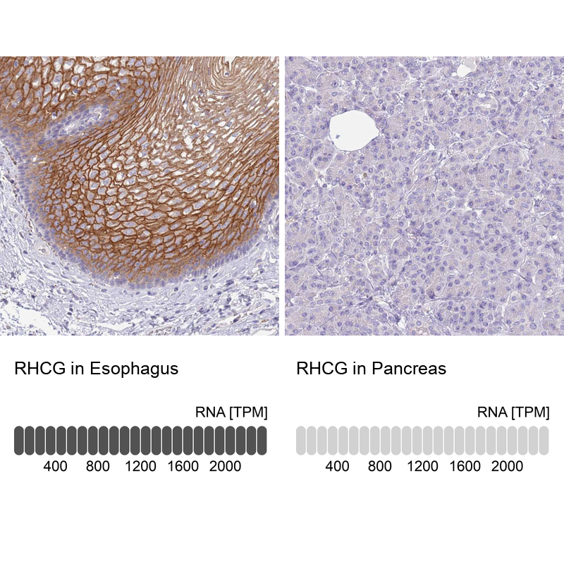 Anti-RHCG Antibody