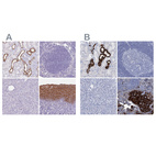 Immunohistochemical staining of human kidney, lymph node, pancreas and squamous epithelia using Anti-RHCG antibody HPA043317 (A) shows similar protein distribution across tissues to independent antibody HPA041874 (B).