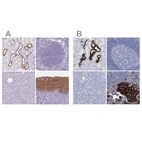 Immunohistochemical staining of human kidney, lymph node, pancreas and squamous epithelia using Anti-RHCG antibody HPA043317 (A) shows similar protein distribution across tissues to independent antibody HPA041874 (B).