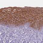 Immunohistochemical staining of human Tonsil shows strong membranous positivity in squamous epithelial cells.