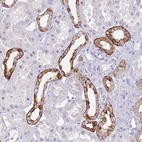 Anti-RHCG Antibody