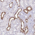 Immunohistochemical staining of human kidney shows strong membranous positivity in cells in distal tubules.