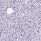 Immunohistochemical staining of human Pancreas shows no membranous positivity in exocrine glandular cells as expected.
