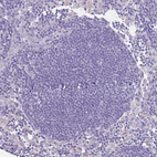 Immunohistochemical staining of human Lymph node shows no membranous positivity in non-germinal center cells as expected.