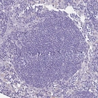 Immunohistochemical staining of human Lymph node shows no membranous positivity in non-germinal center cells as expected.