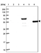 Lane 1: Marker [kDa] 250, 130, 95, 72, 55, 36, 28, 17, 10_br/_Lane 2: Human cell line RT-4_br/_Lane 3: Human cell line U-251MG sp_br/_Lane 4: Human plasma (IgG/HSA depleted)_br/_Lane 5: Human liver tissue_br/_Lane 6: Human tonsil tissue