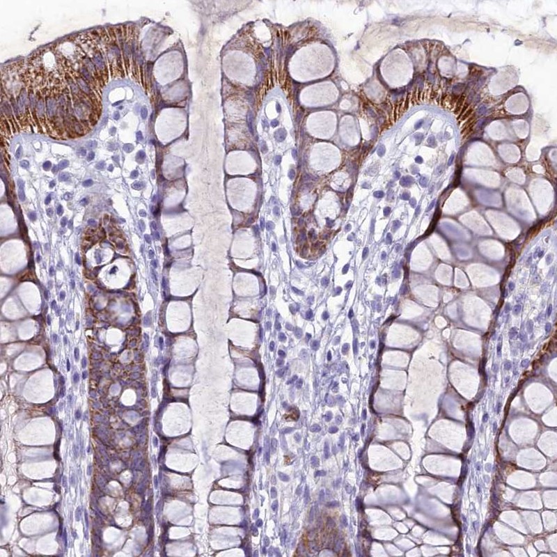 Anti-HIGD1A Antibody