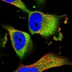 Immunofluorescent staining of human cell line U-251 MG shows localization to cytosol.