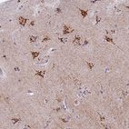 Immunohistochemical staining of human cerebral cortex shows strong positivity in cytoplasm granular in neurons.