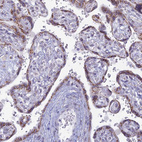 Immunohistochemical staining of human placenta shows strong positivity in cytoplasm granular in trophoblastic cells.