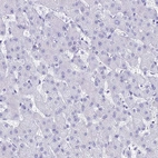 Immunohistochemical staining of human liver shows no positivity in hepatocytes as expected.