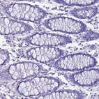 Immunohistochemical staining of human colon shows no positivity in glandular cells as expected.
