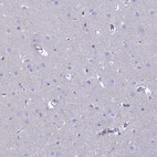 Immunohistochemical staining of human cerebral cortex shows no positivity in neurons as expected.