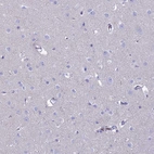 Immunohistochemical staining of human cerebral cortex shows no positivity in neurons as expected.