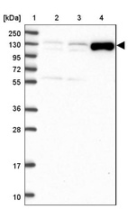 Lane 1: Marker [kDa] 250, 130, 95, 72, 55, 36, 28, 17, 10_br/_Lane 2: Human cell line RT-4_br/_Lane 3: Human cell line U-251 MG_br/_Lane 4: Human plasma