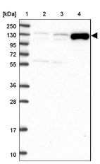 Lane 1: Marker [kDa] 250, 130, 95, 72, 55, 36, 28, 17, 10_br/_Lane 2: Human cell line RT-4_br/_Lane 3: Human cell line U-251 MG_br/_Lane 4: Human plasma