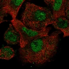 Immunofluorescent staining of human cell line A549 shows localization to nucleoplasm.