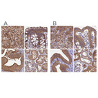 Anti-STUB1 Antibody