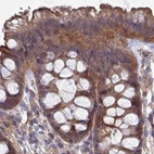 Immunohistochemical staining of human colon using Anti-STUB1 antibody HPA043531.