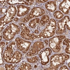 Immunohistochemical staining of human kidney shows strong cytoplasmic granular positivity in cells in tubules.