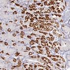 Anti-DHX34 Antibody