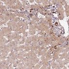 Anti-PGLYRP2 Antibody