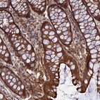 Anti-CRTAP Antibody