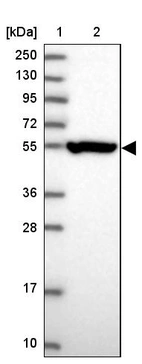 Lane 1: Marker [kDa] 250, 130, 95, 72, 55, 36, 28, 17, 10_br/_Lane 2: Human cell line RT-4
