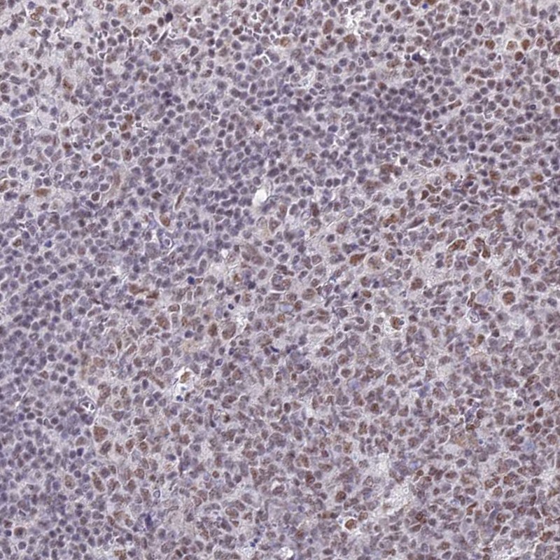 Anti-RBM12 Antibody
