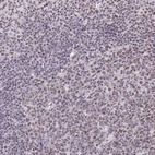 Anti-RBM12 Antibody