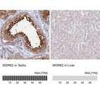 Anti-WDR62 Antibody