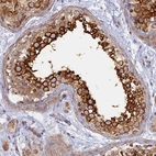 Immunohistochemical staining of human testis shows high expression.