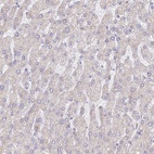 Anti-WDR62 Antibody