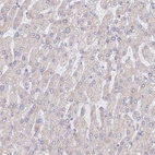 Immunohistochemical staining of human liver shows low expression as expected.