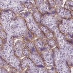Immunohistochemical staining of human placenta shows strong membranous positivity in trophoblastic cells.