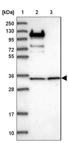 Lane 1: Marker [kDa] 250, 130, 95, 72, 55, 36, 28, 17, 10_br/_Lane 2: Human cell line RT-4_br/_Lane 3: Human cell line U-251MG sp