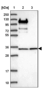Lane 1: Marker [kDa] 250, 130, 95, 72, 55, 36, 28, 17, 10_br/_Lane 2: Human cell line RT-4_br/_Lane 3: Human cell line U-251MG sp