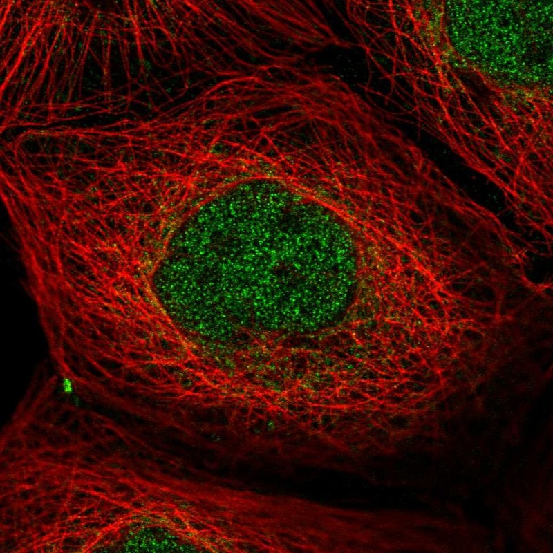 Anti-PPP1R2 Antibody