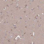 Immunohistochemical staining of human cerebral cortex shows strong cytoplasmic positivity in neurons.