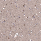 Immunohistochemical staining of human cerebral cortex shows strong cytoplasmic positivity in neurons.