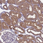 Immunohistochemical staining of human kidney shows strong cytoplasmic positivity in cells in tubules.
