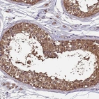 Immunohistochemical staining of human testis shows strong cytoplasmic positivity in cells in seminiferous ducts.