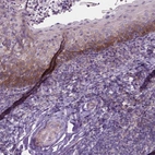Immunohistochemical staining of human tonsil shows moderate membranous positivity in squamous epithelial cells.