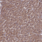 Immunohistochemical staining of human liver shows moderate cytoplasmic positivity in hepatocytes.