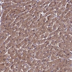 Immunohistochemical staining of human liver shows moderate cytoplasmic positivity in hepatocytes.