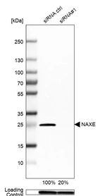 Western blot analysis in MCF-7 cells transfected with control siRNA, target specific siRNA probe #1, using Anti-NAXE antibody. Remaining relative intensity is presented. Loading control: Anti-GAPDH.
