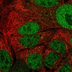 Immunofluorescent staining of human cell line CACO-2 shows localization to nucleoplasm.
